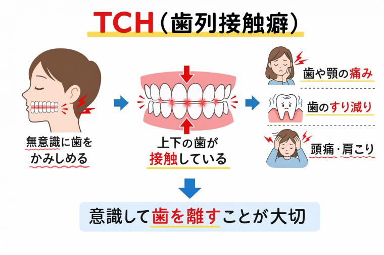 TCH（歯列接触癖）とは？  ～知らぬ間に歯と顎に負担をかけていませんか？～